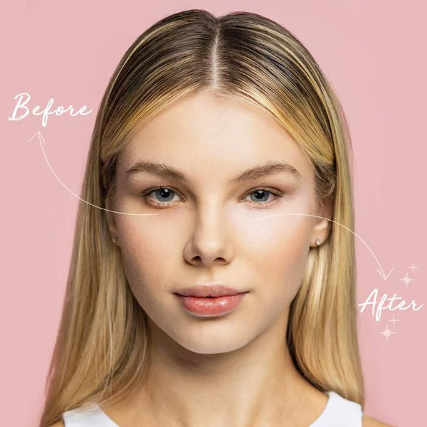 🎄Buy 1 Get 1 Free🎅Under Eye Brightener, Conceal & Brighten Dark Circles