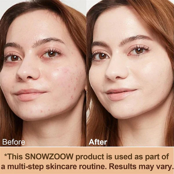🔥2026 Hot Sale 50% OFF✨⚡ 50K+ SOLD! 🎁4-in-1 Perfecting Foundation – High Coverage, SPF & All-Day Hydration 🤍✨