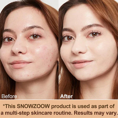 🔥2026 Hot Sale 50% OFF✨⚡ 50K+ SOLD! 🎁4-in-1 Perfecting Foundation – High Coverage, SPF & All-Day Hydration 🤍✨