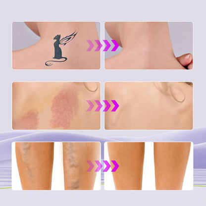 🎁Buy 1 Get 1 Free with FREE BODY BRUSH ✨- Body Coverage Perfector✨