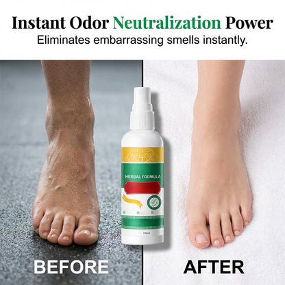 🥳2026 HOT SALE🥳💞50K+ SOLD! 🦶✨ BUY 1 GET 1 FREE! Herbal Foot Care Spray – softens tough calluses, smooths cracked heels. Natural botanical extracts nourish & restore – silky soft feet in days, no salon needed! 🌿💚